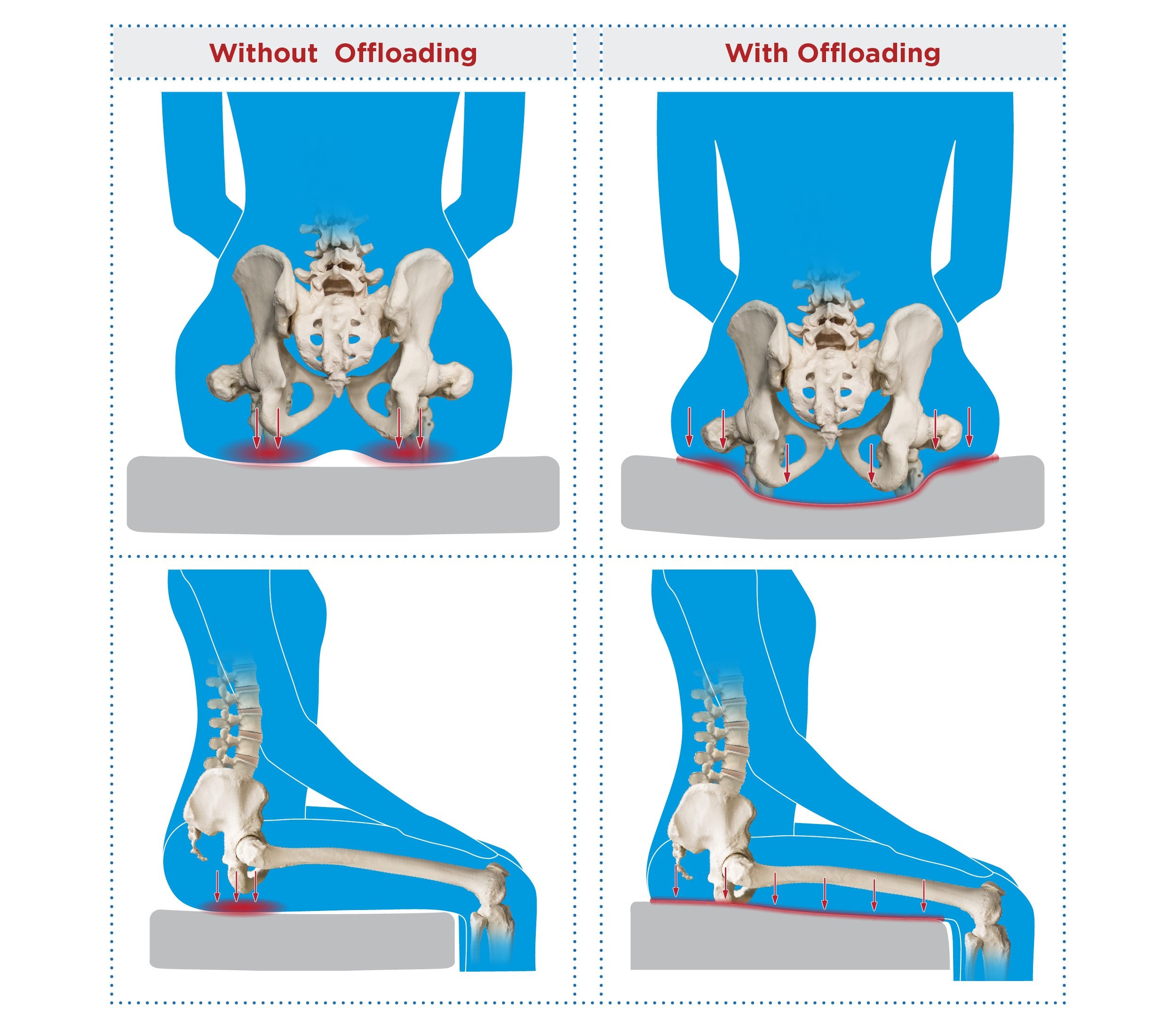 Wheelchair Seating & Positioning Guide